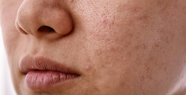 Close-up of the skin on someone's face