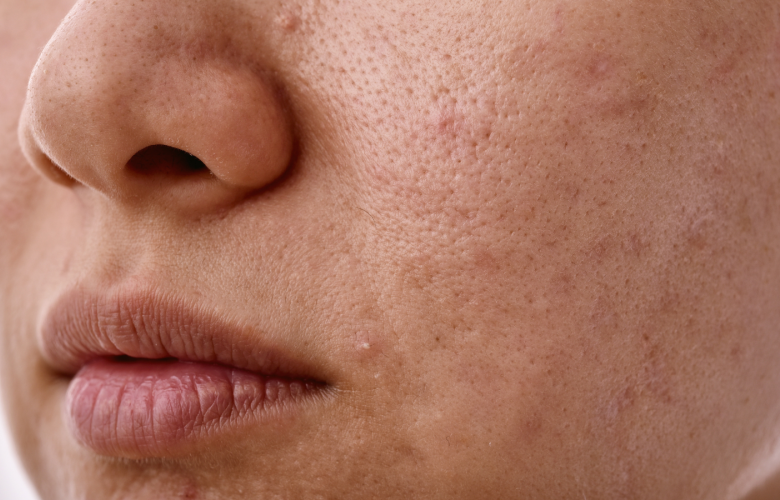 Close-up of the skin on someone's face